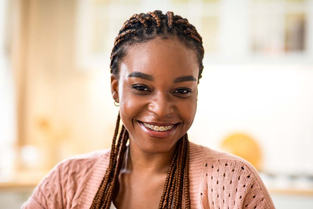 Close-up of woman with confident smile, highlighting cosmetic dentistry results